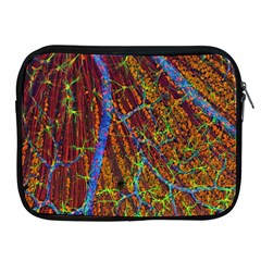 Neurobiology Apple Ipad 2/3/4 Zipper Cases by BangZart