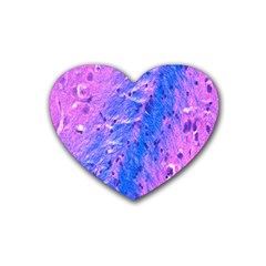 The Luxol Fast Blue Myelin Stain Rubber Coaster (heart)  by Mariart