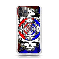 The Grateful Dead Iphone 11 Pro 5 8 Inch Tpu Uv Print Case by Grandong